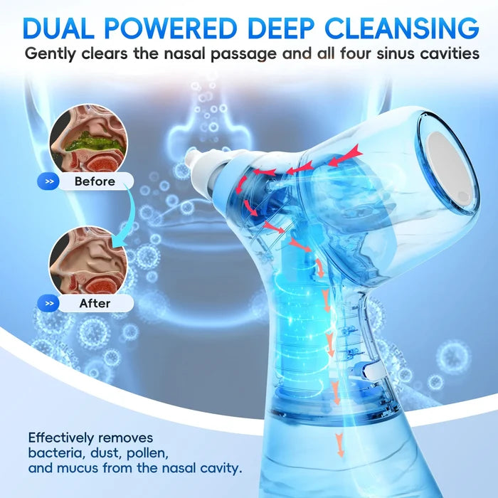 Nasal Irrigation System for Fast Sinus & Allergy Relief